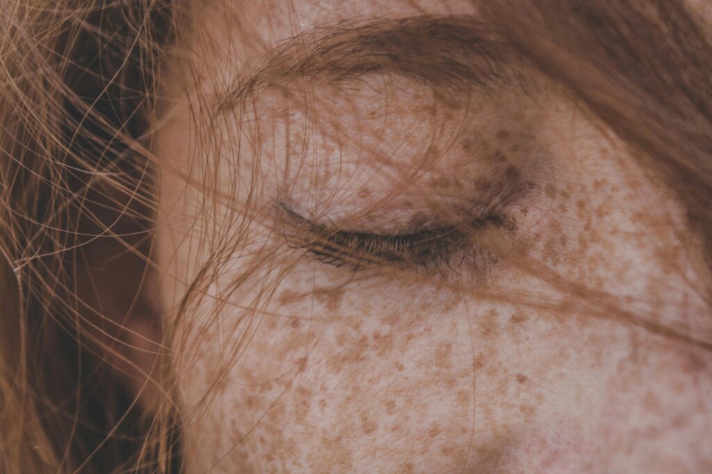 Detailed close-up of a freckled face with closed eye and hair, highlighting skin texture.